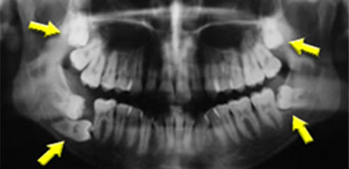 cirurgia_01